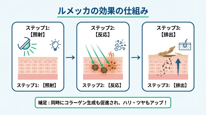 ルメッカがシミに効く仕組みを図解したインフォグラフィック